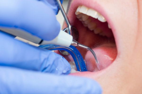 Grand Rapids - Gum Disease Treatment - Firlik Family Dentistry